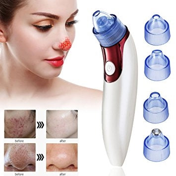 Electric Blackhead Suction Vacuum